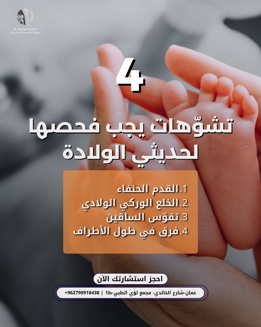 تشوهات الأطفال