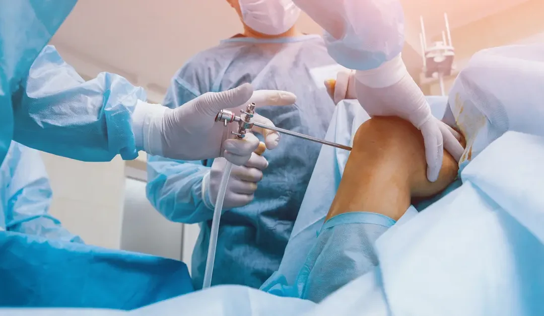 منظار الركبة وعلاج تمزق الغضروف الهلالي والرباط الصليبي في الأردن – دقة حديثة وارتكاز علمي