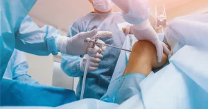منظار الركبة وعلاج تمزق الغضروف الهلالي والرباط الصليبي في الأردن – دقة حديثة وارتكاز علمي